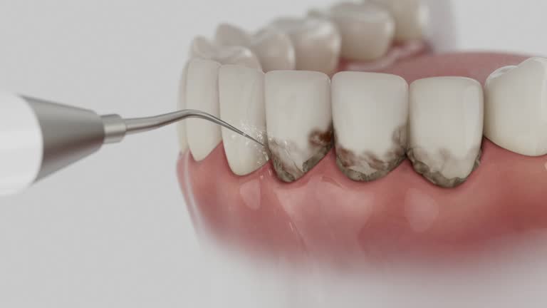 Reliable Dental contractor in Loma, CO by Smile Center Dentistry